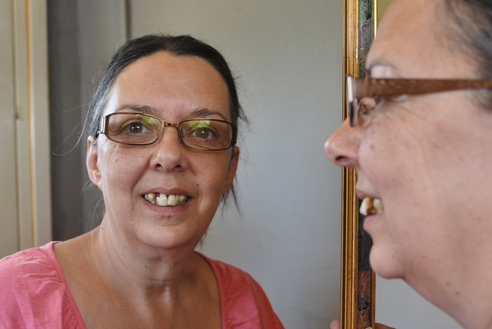 Three Time’s A Charm For Desperate Woman Who Pulled Her Teeth